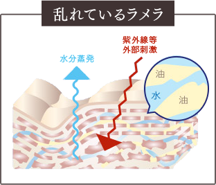乱れているラメラ
