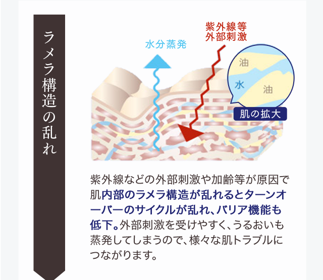 ラメラ構造の乱れ